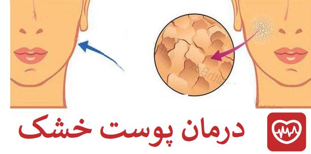 دکتر پوست برای درمان پوست خشک شرق تهران
