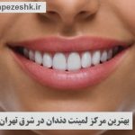 مرکز خوب لمینت دندان در شرق تهران کجاست ؟