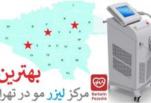 بهترین مرکز لیزر مو در تهران