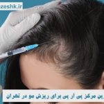 بهترین مرکز پی آر پی برای ریزش مو در تهران