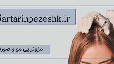 بهترین مرکز مزوتراپی مو و صورت در تهران