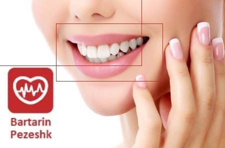 دندانپزشکی زیبایی در تهرانسر