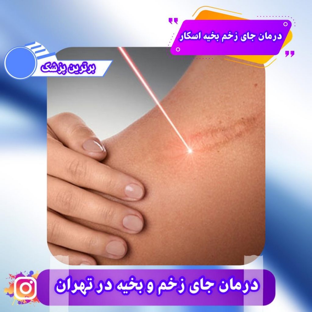 مرکز درمان جای زخم و بخیه در تهران