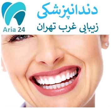 بلیچینگ برای دندانپزشکی زیبایی غرب تهران