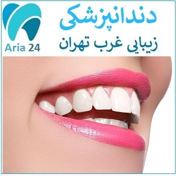 اقدامات دندانپزشکی زیبایی غرب تهران