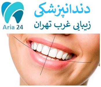 بهترین دندانپزشکی زیبایی غرب تهران