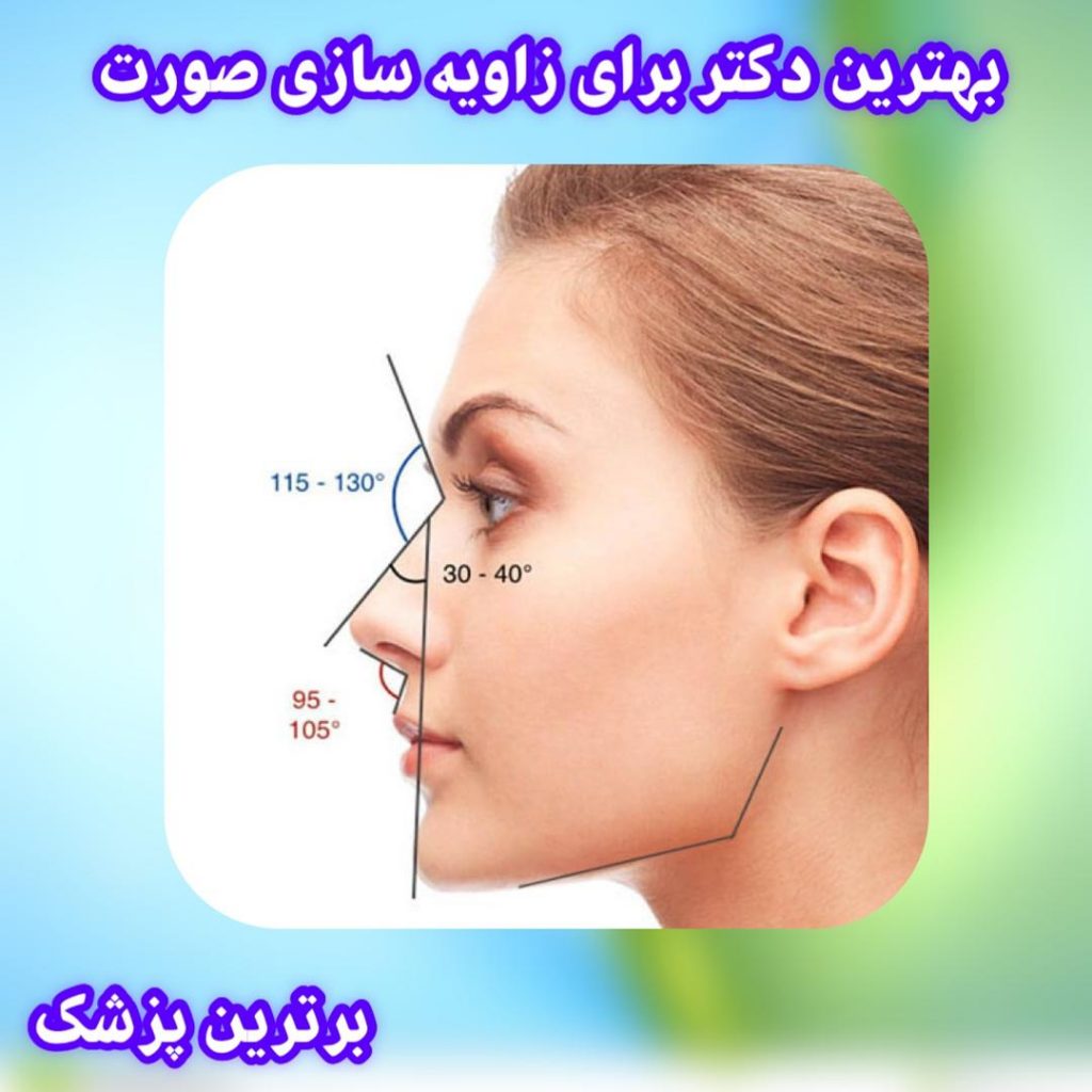 بهترین دکتر برای زاویه سازی صورت در تهران