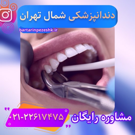 مرکز دندانپزشکی شمال تهران مشاوره و ویزیت