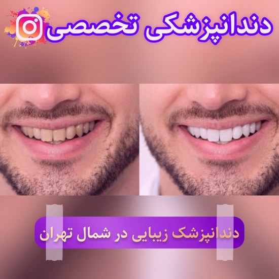 دندانپزشکی در شمال تهران