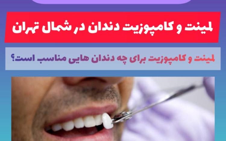 لمینت و کامپوزیت دندان شمال تهران