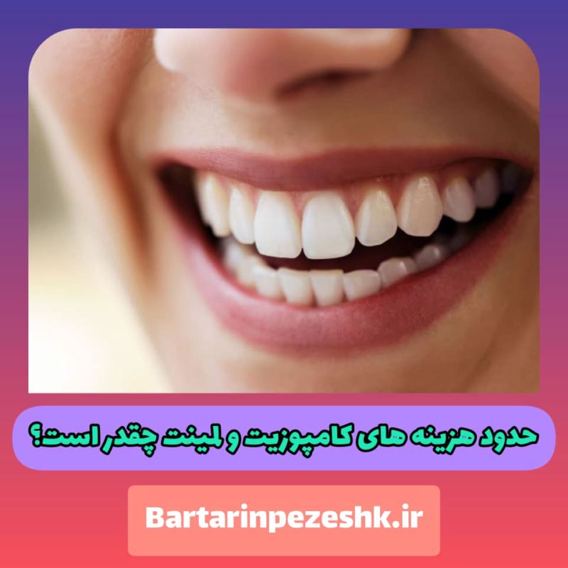 لمینت و کامپوزیت دندان شمال تهران