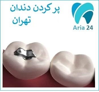 پر کردن دندان غرب تهران