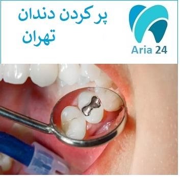 دندانپزشکی برای پر کردن دندان شرق تهران