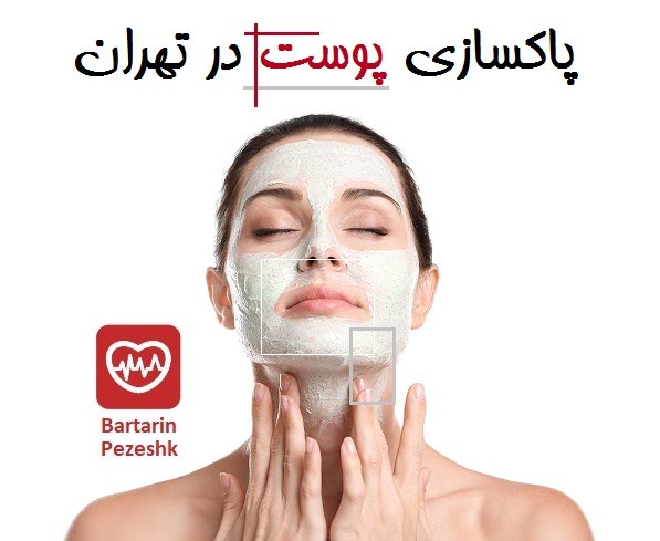 پاکسازی پوست در تهران
