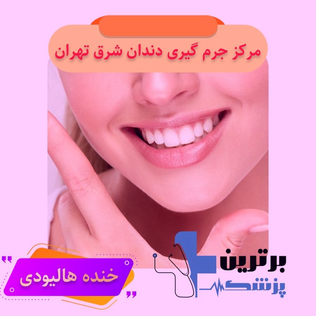 جرم گیری دندان شرق تهران3