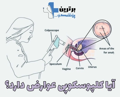 دکتر کولپوسکوپی در غرب تهران